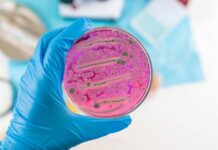 A hand holding a petri dish with pink bacterial growth