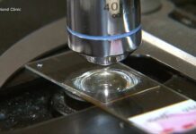 8-year-old dies from rare brain-eating amoeba