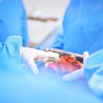 Surgeons in blue scrubs handling an organ during surgery