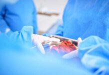 Surgeons in blue scrubs handling an organ during surgery