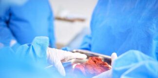 Surgeons in blue scrubs handling an organ during surgery