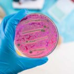 Deadly Amoeba Strikes — Teen Dead Days Later A hand holding a petri dish with pink bacterial growth