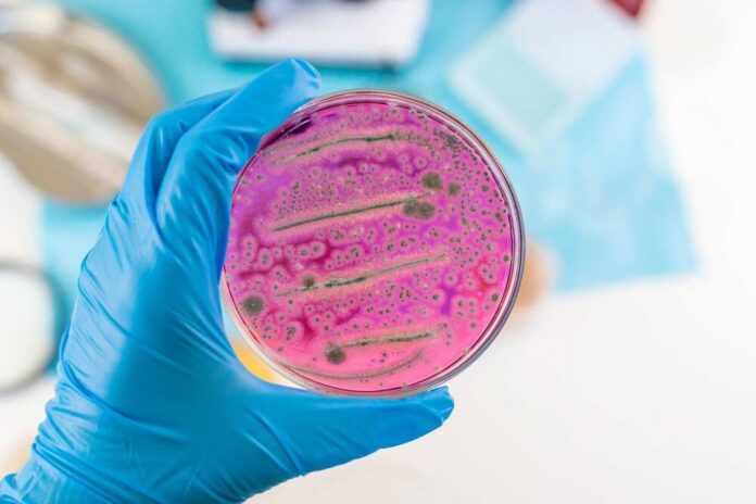 Examine,Bacteria,In,Petri,Dishes,In,The,Laboratory.,Selective,Focus. A hand holding a petri dish with pink bacterial growth