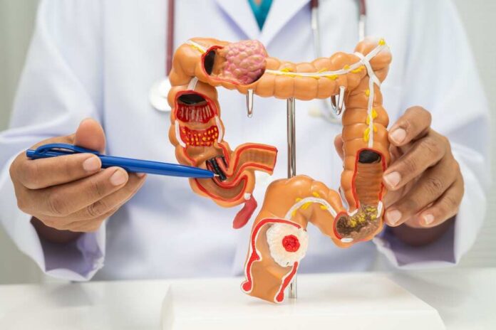Healthcare professional demonstrating a digestive system model